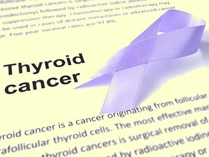 Aggressive Approach to Anaplastic Thyroid Cancer Shows Benefit