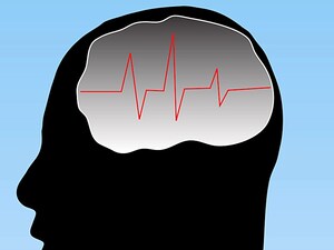 Transcranial Stimulation May Quell Cravings in Obese Subjects