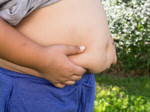 Bariatric Surgery May Aid Very Obese Teens, 3-Year Data Show
