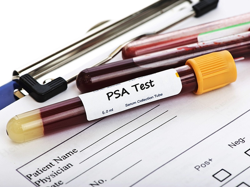 Cooler Heads Prevail: Medicare Rethinks PSA Testing Penalty