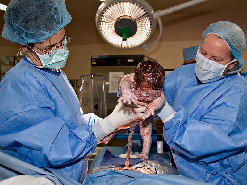 1 In 6 Hospitals Have Cesarean Rates Above 33 Report Finds