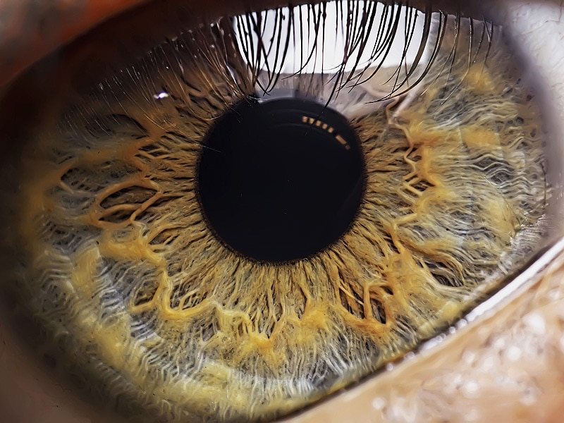 ADHD Do the Eyes Have It?