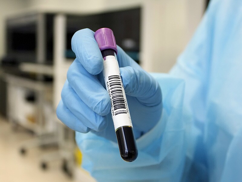 Blood Test for Colorectal Cancer The Last Resort?