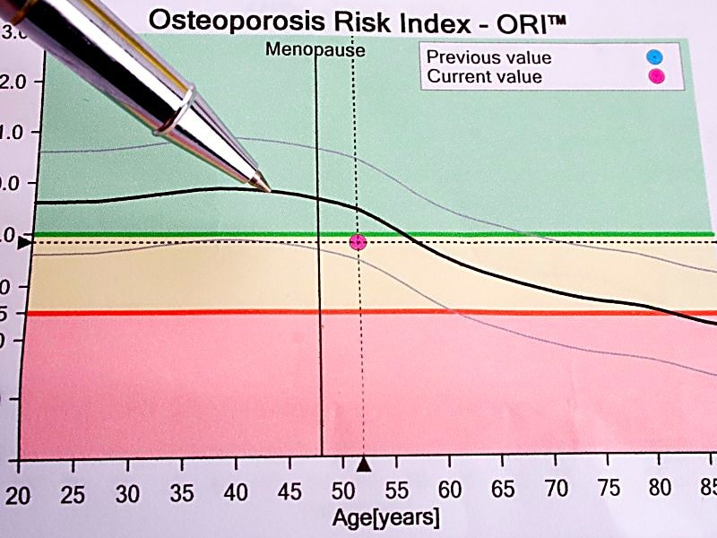 Previous values. Диаграмма индекса риска остеопороза. Bone density and age.