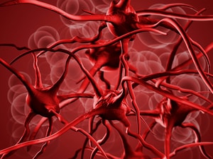 Mild Anemia Predicts Poor Outcome After Intracerebral Hemorrhage