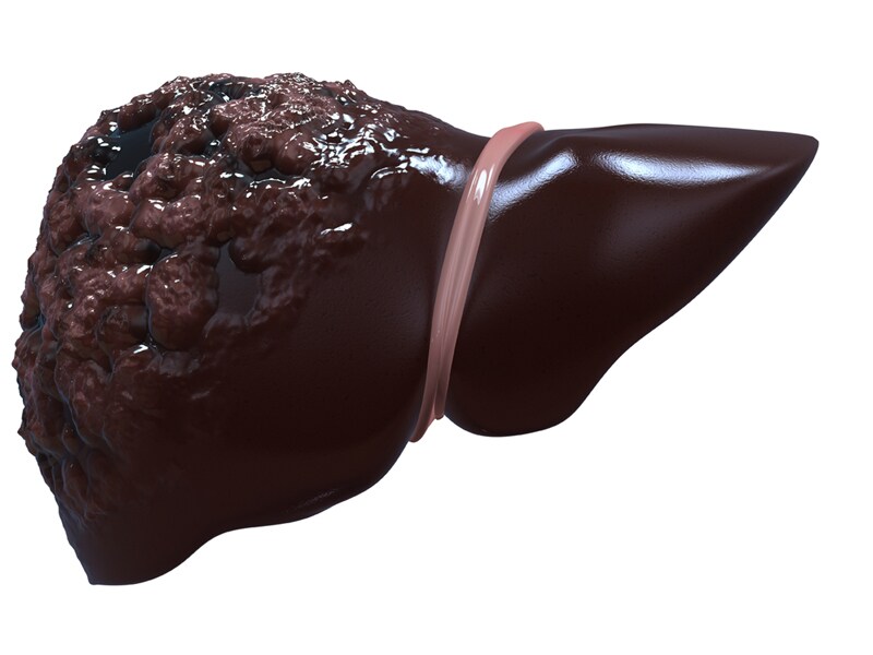 are antivirals bad for your liver