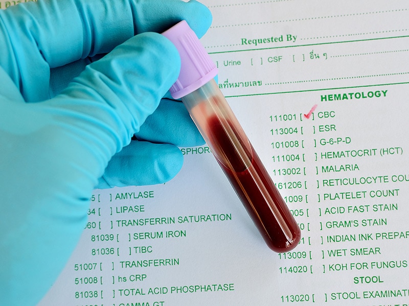 quest diagnostics blood test appointment