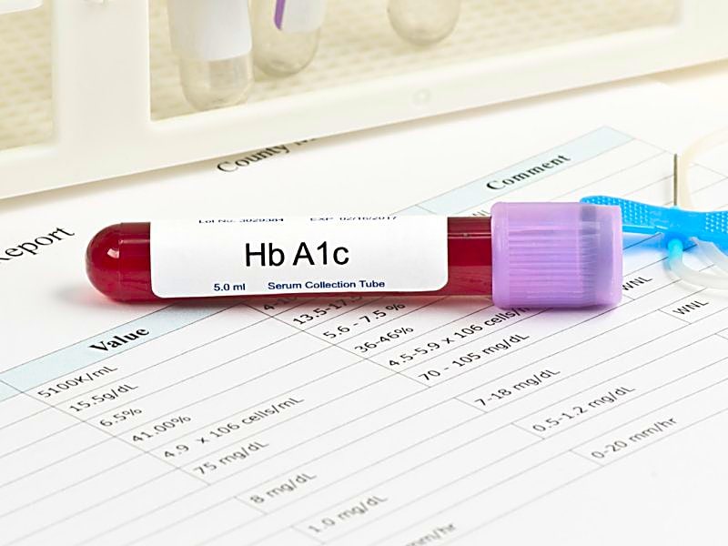 C 1 tests. Hba1c тест. A1c HB Test. Гликированный гемоглобин пробирка. Гликированный гемоглобин hba1с (hba1с, glycated hemoglobin, GHB).