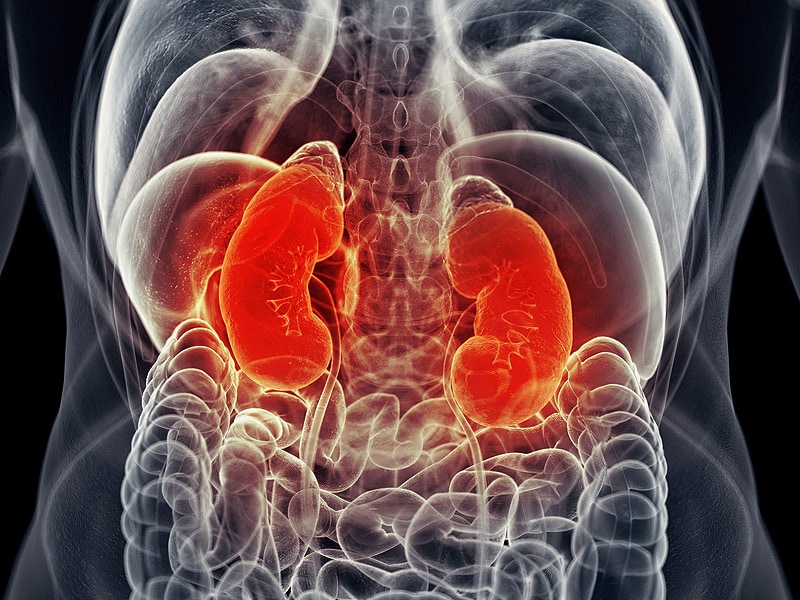 what-are-the-most-common-kidney-tumor-symptoms-with-pictures