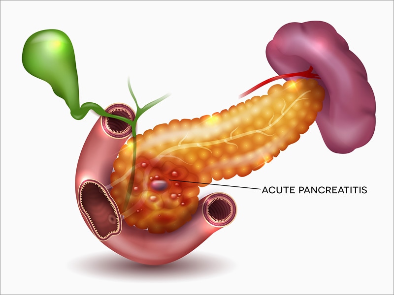 Early Feeding May Benefit Patients With Mild Pancreatitis