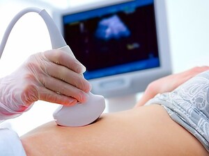 Early-Onset Preeclampsia Linked to Cardiac Remodeling