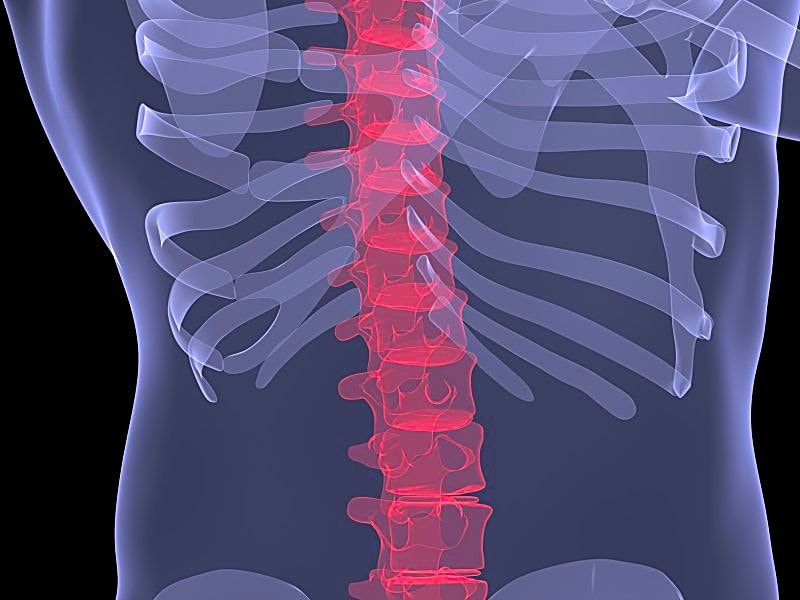 Рассмотрите рентгенограмму с изображением позвоночника человека