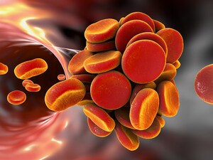 Oral Agents for Cancer-Related VTE: 'New Standard of Care'