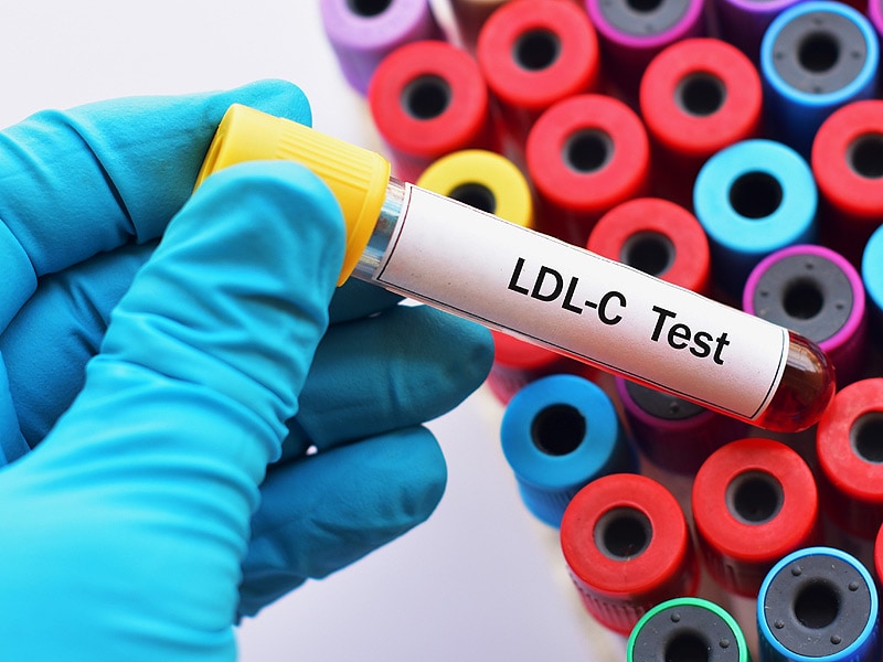 Novel Equation Gives More Precise LDLC, Even Without Fasting