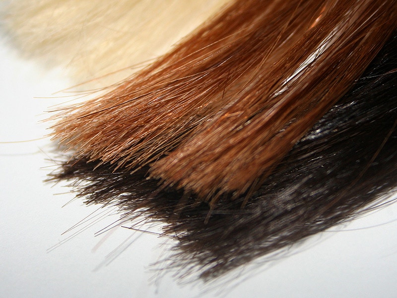 Cortisol in Hair a Biomarker for Stress, Treatment Efficacy