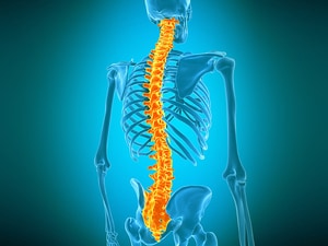 Female Paraplegic Patients Regain Function With Spinal Stimulation