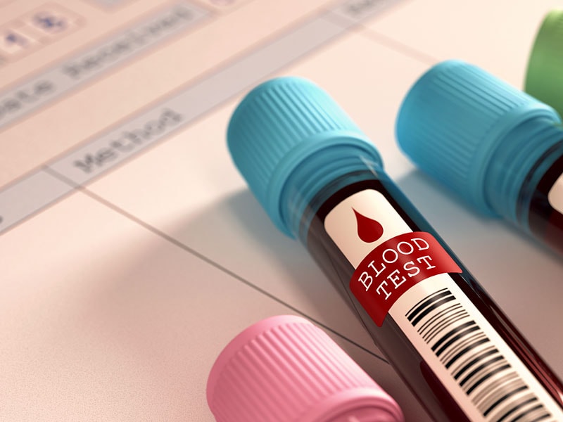 can-diabetes-be-diagnosed-in-a-single-blood-test