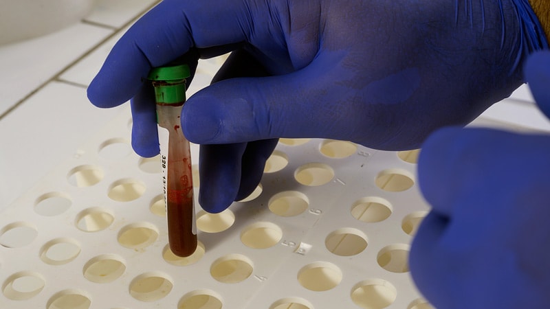 Blood Test for MS Activity Gets FDA Breakthrough Designation