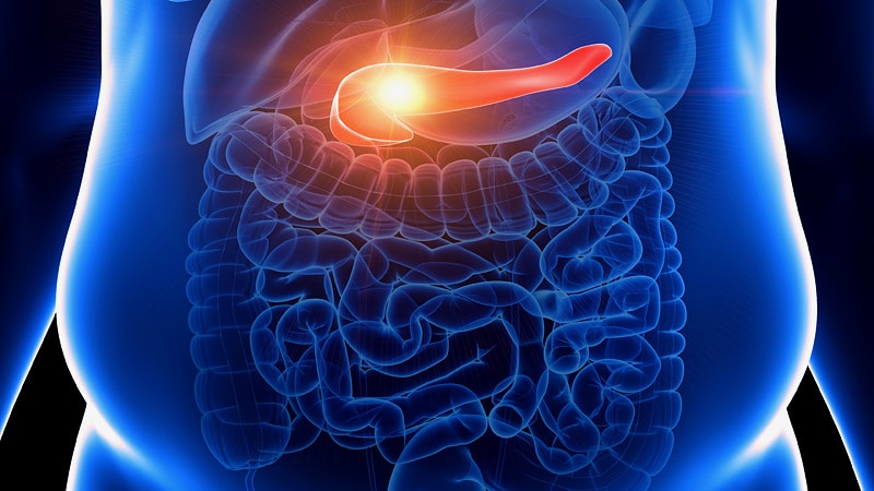 Teenage Obesity & Fourfold Increase in Risk for Pancreatic Cancer