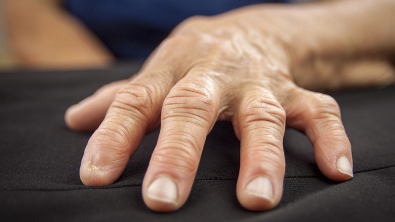 Les patients souffrant de rhumatismes ont un vieillissement prématuré du système immunitaire