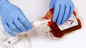 Choosing Wisely Champions Cut Blood RBC Transfusions, HIT testing
