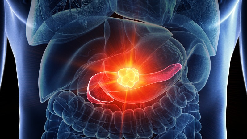 Pancreatic Cancer Elevated After Solid Organ Transplant | MedMDS