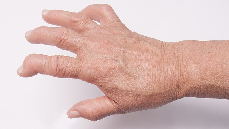 rheumatoid arthritis medication medscape