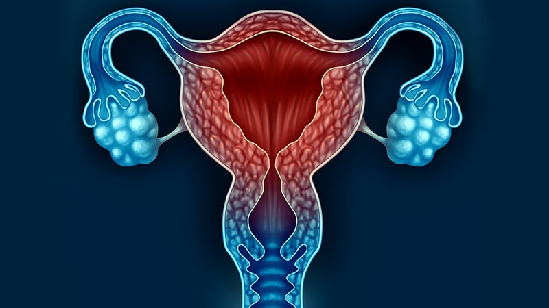 Image result for women uterus cancer