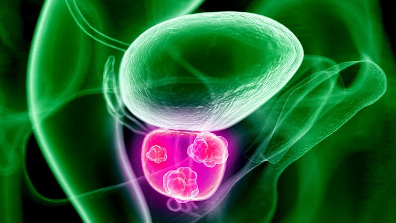 medscape prostate cancer screening
