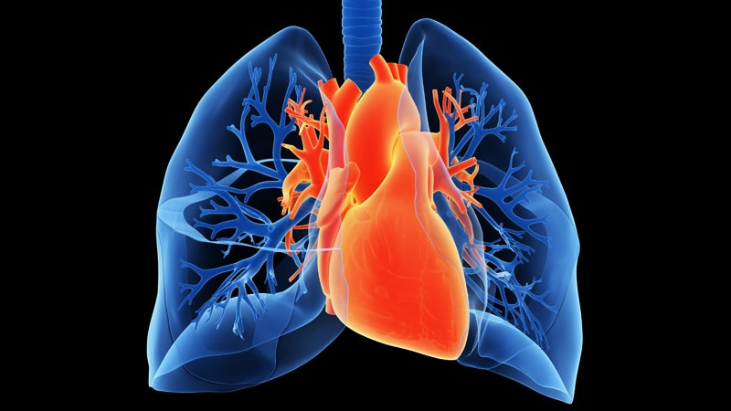 La dénervation de l’artère pulmonaire franchit une nouvelle étape dans l’hypertension