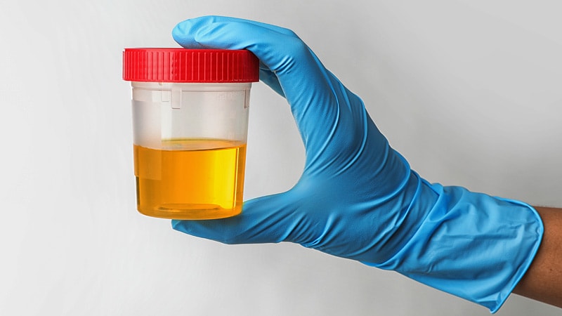La valeur de l’analyse d’urine de dépistage avant les procédures de bureau remise en question