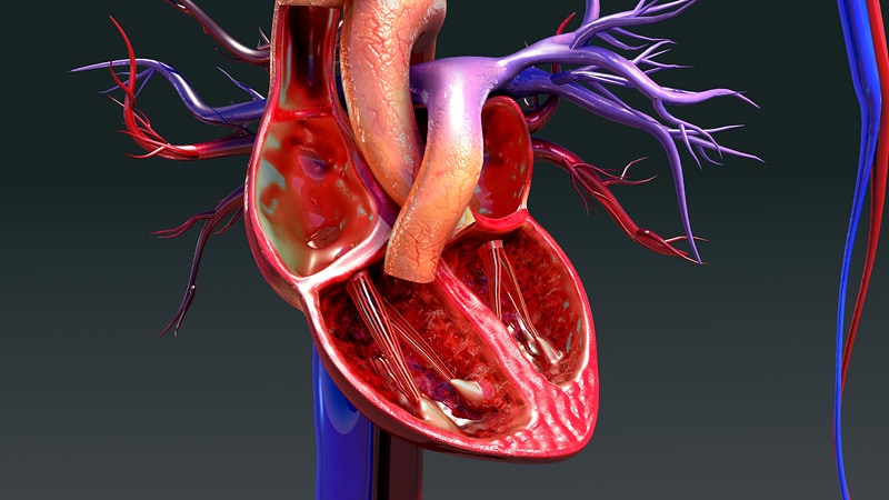 Le cœur sphérique peut prédire la cardiomyopathie, la FA