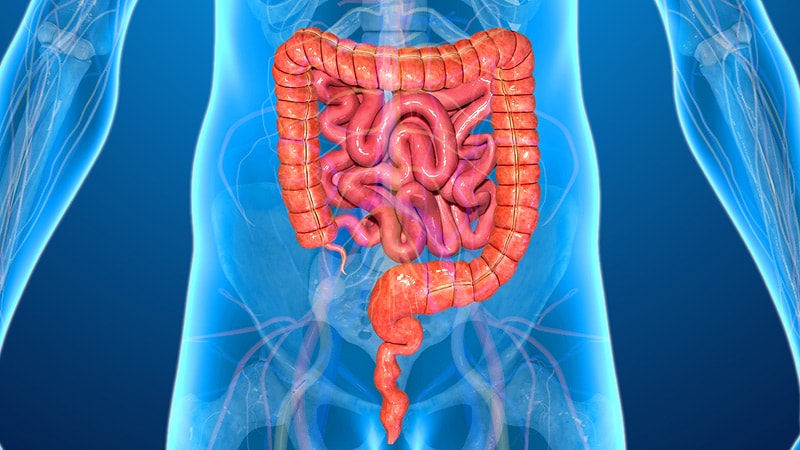 Patient Risk Key to Timing Biologics in IBD thumbnail