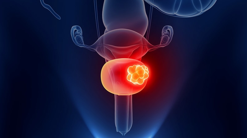 Novel Drug for Advanced Urothelial Cancer Enfortumab Vedotin