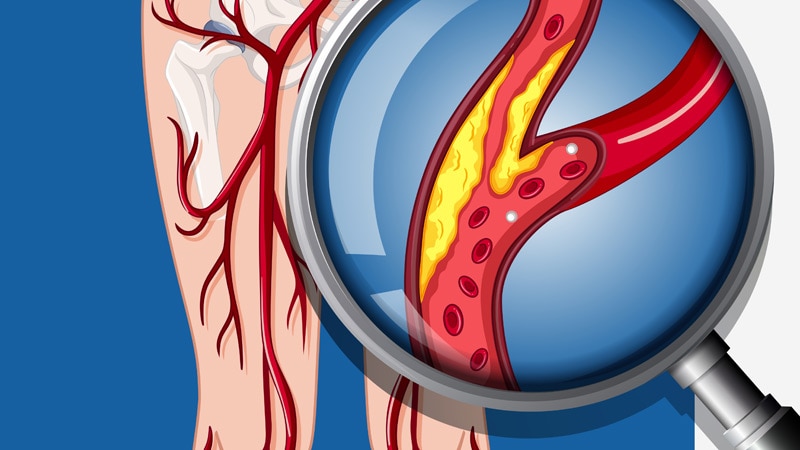 SAFE-PAD: Paclitaxel Devices Exonerated in Real-World Data 2 SAFE-PAD: Paclitaxel Devices Exonerated in Real-World Data