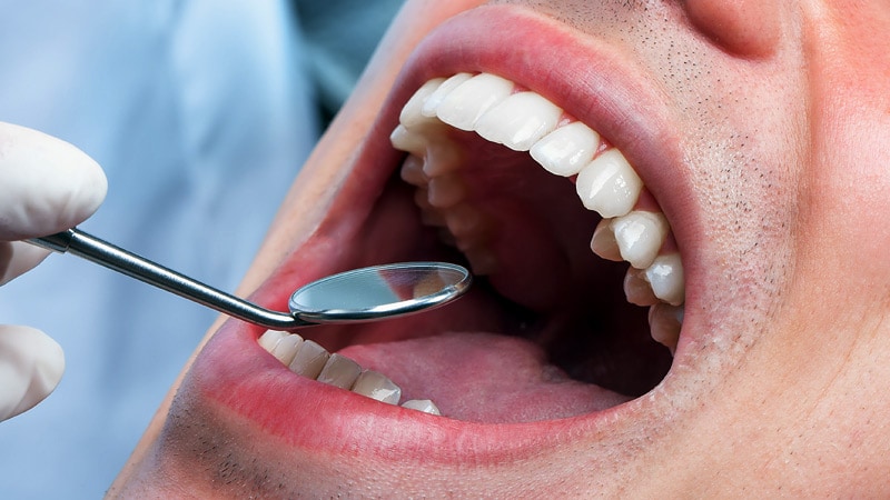 Tackling The Complications From Oral Cancer And Treatment