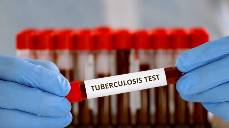 Global Latent TB Infection Testing Market