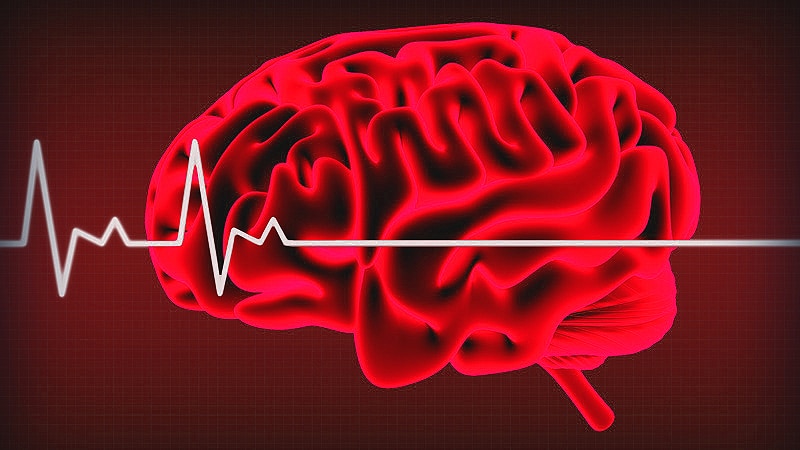 Criteria For Brain Death Mnemonic