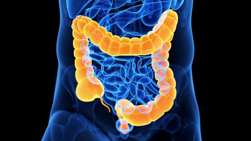 Differences in Right vs Left Colon in Black vs White Individuals