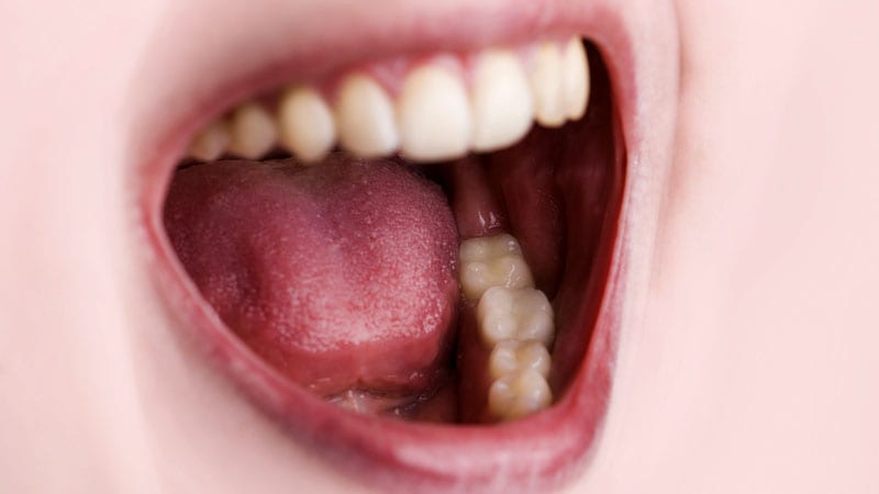 common-causes-of-thick-saliva-in-throat-and-home-remedies