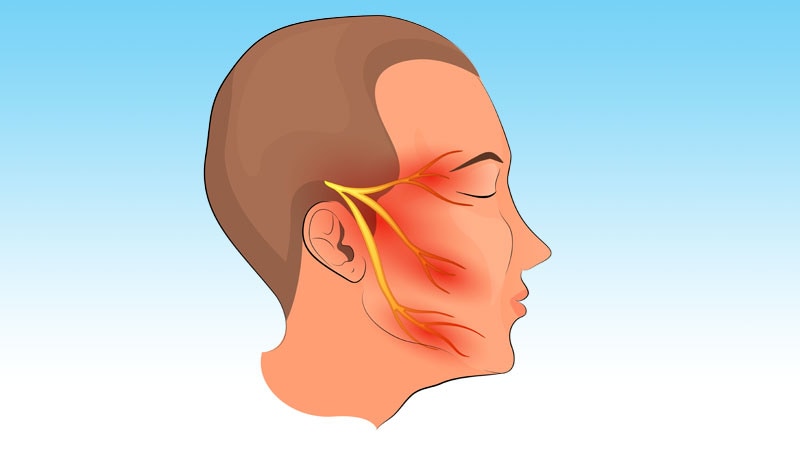 Trigeminal Neuralgia: Intraorbital Cuts Help Some Patients