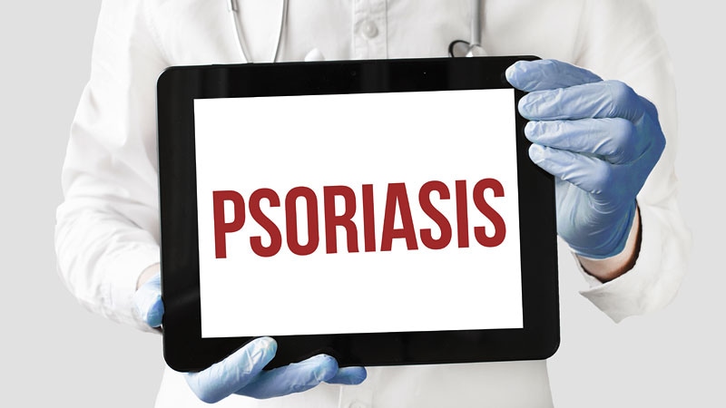 Obesity or Psoriasis: What Comes First?