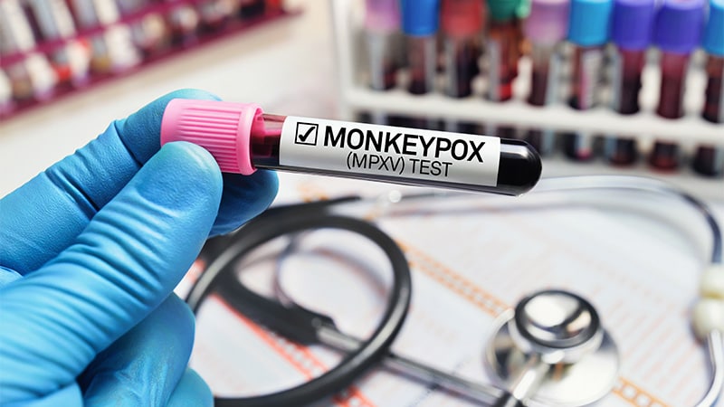 Le Monkeypox devrait-il être considéré comme une MST ?  Débat d’experts