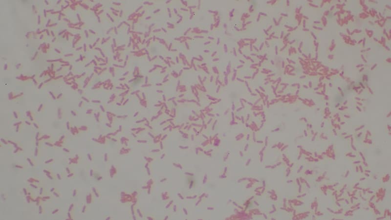 Des bactéries potentiellement mortelles détectées dans le sol américain