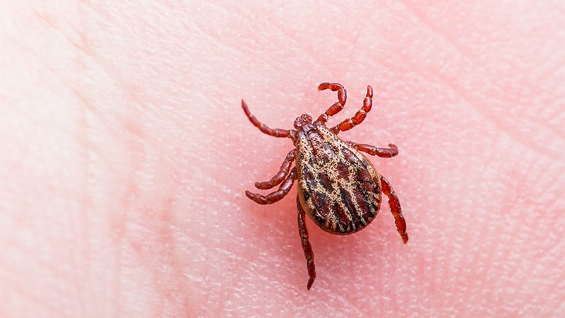 Les données d’assurance montrent une forte augmentation de la maladie de Lyme aux États-Unis