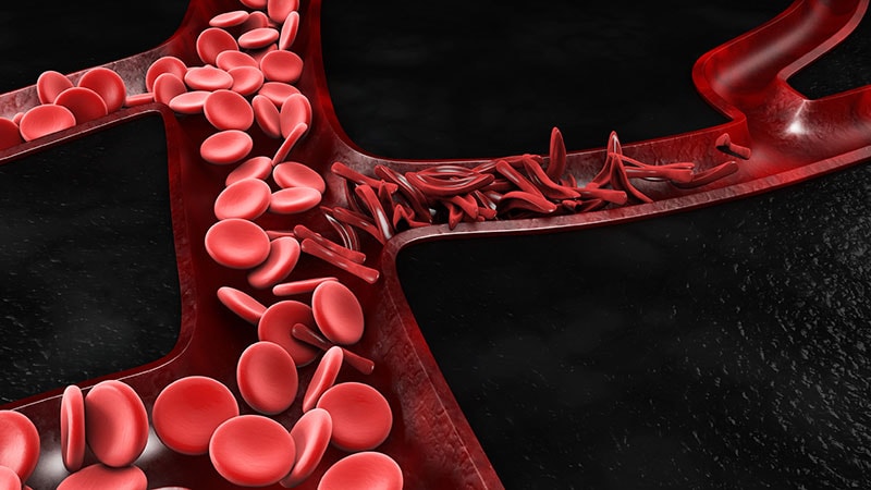 Fast Five Quiz: Iron-Deficiency Anemia Practice Essentials