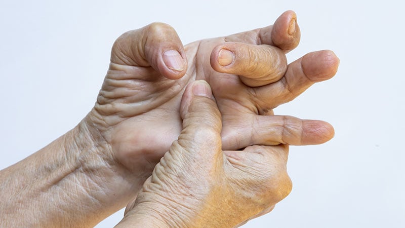 High A1c increases trigger finger risk in both diabetes types