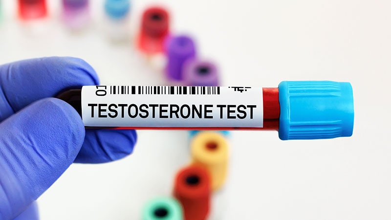 Les niveaux de testostérone chez les jeunes hommes pourraient aider à classer les carences
