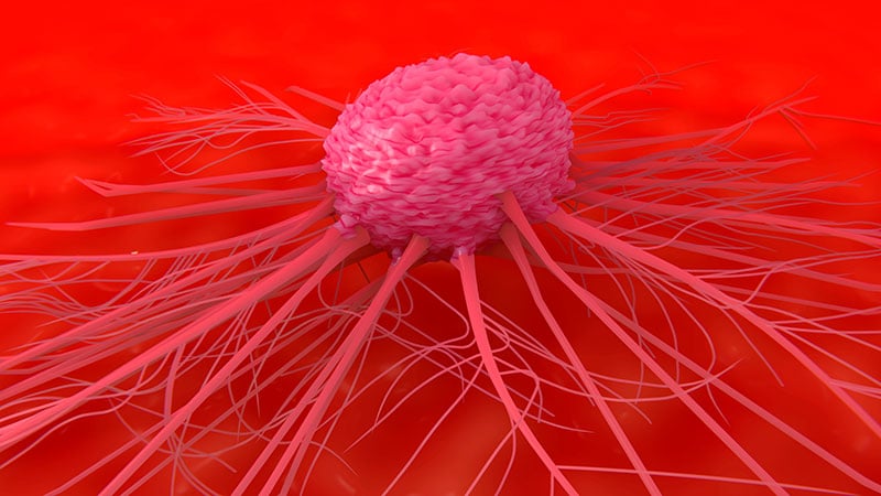 L’étude des croyances sur les causes du cancer suscite un débat