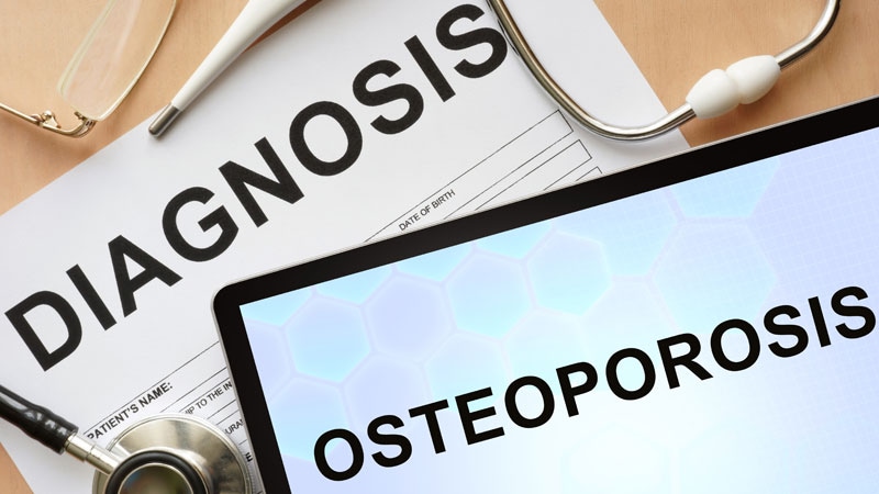 New osteoporosis guidelines say start with bisphosphonates